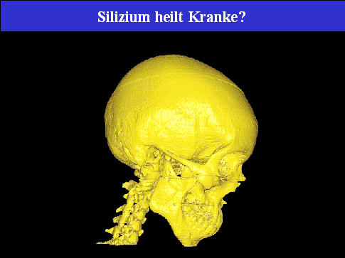 Tomographie